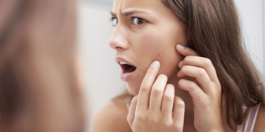 Understanding and Controlling Acne